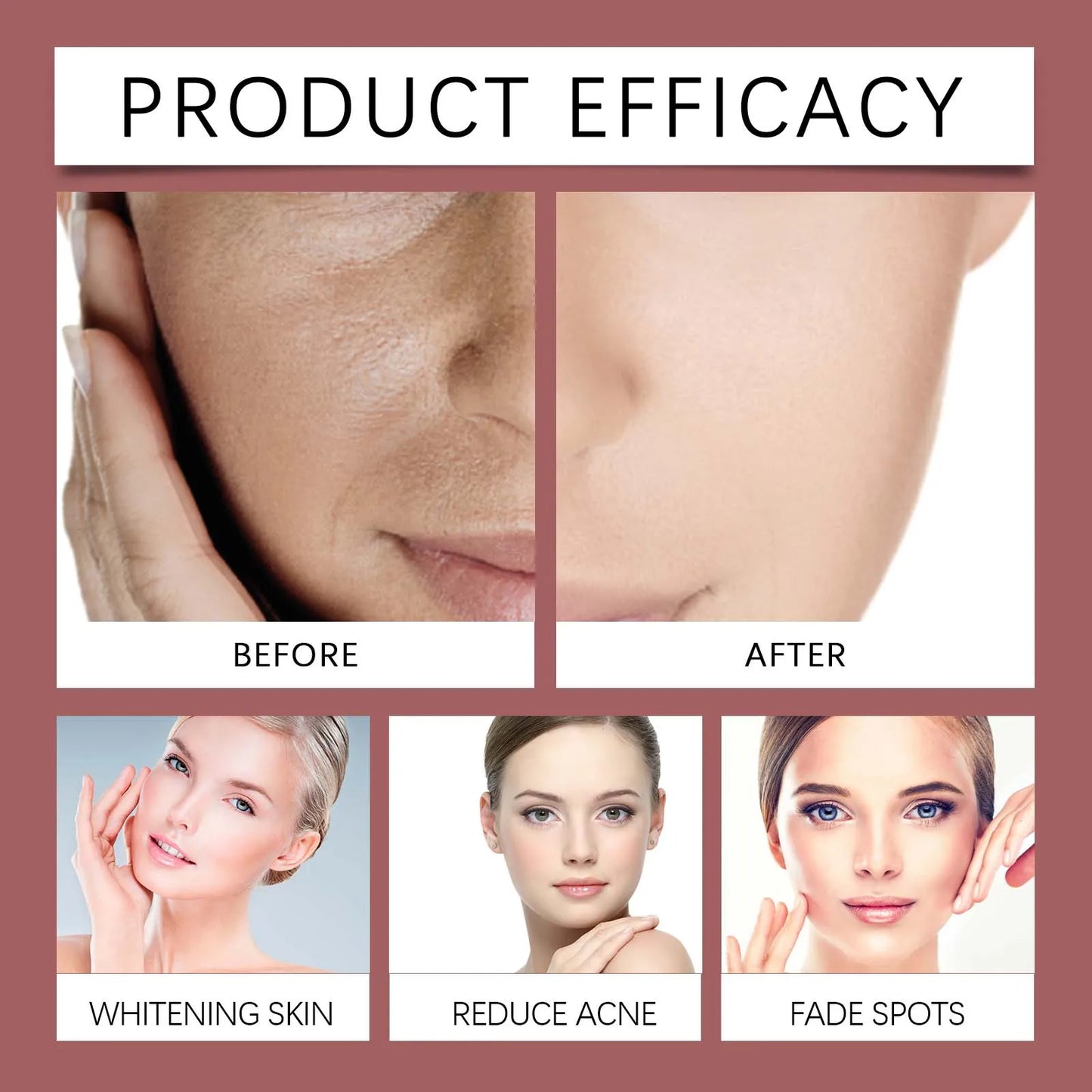 Peeling Face Serum Anti Acne Brightening Exfoliating Shrink Pores Salicylic Acid AHA Serum Reduces Blackheads Smoothing Facial