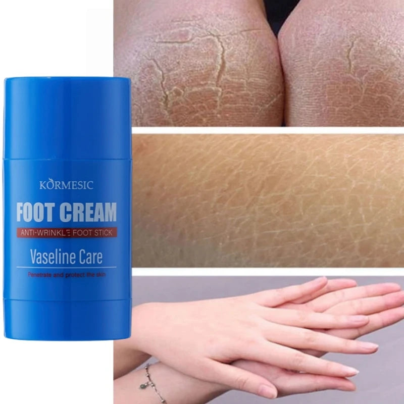 60% Urea Foot Cream Feet Heel Anti-Chapping Ultra-hydrating Softening Dry Cracked Product Gentle Exfoliation Daily Hand Foot Car