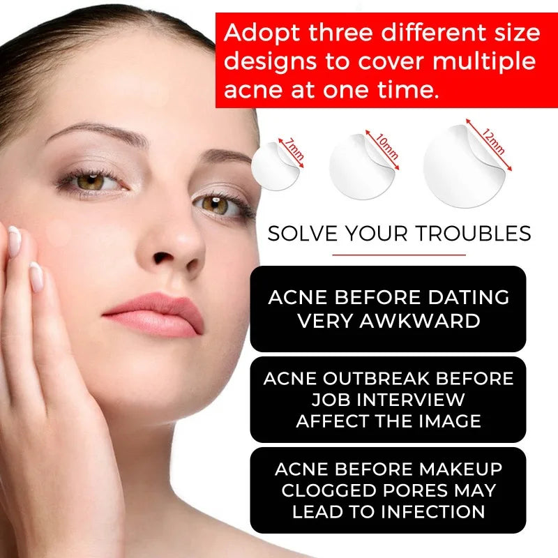 Acne Patch Pimple Cover Repair Facial Acne Treatment Smooth Skin Care Non-Irritating Mild Acne Pimple Patch