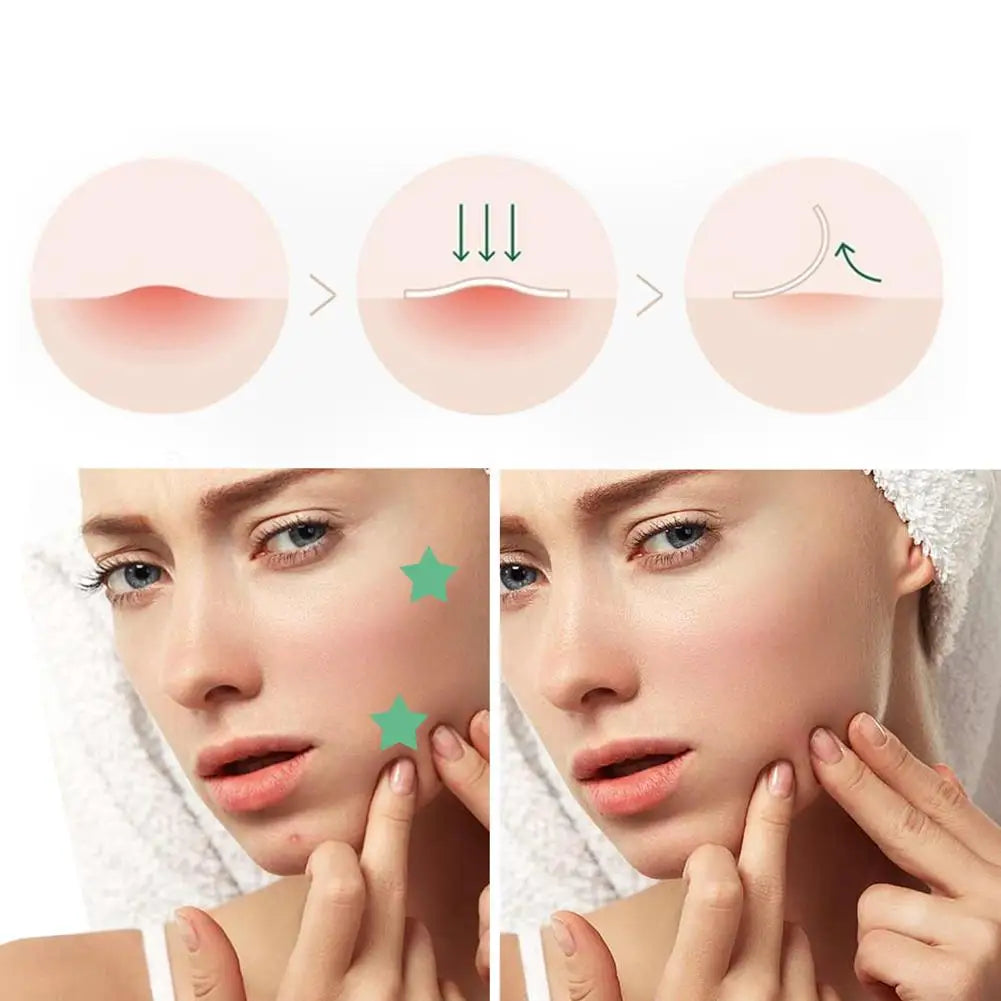 Acne Dot Patches Anti-allergy Sticker Star/Heart Shaped Acne Cover Patch Invisible Healing Acne Treatment Pimple Remover