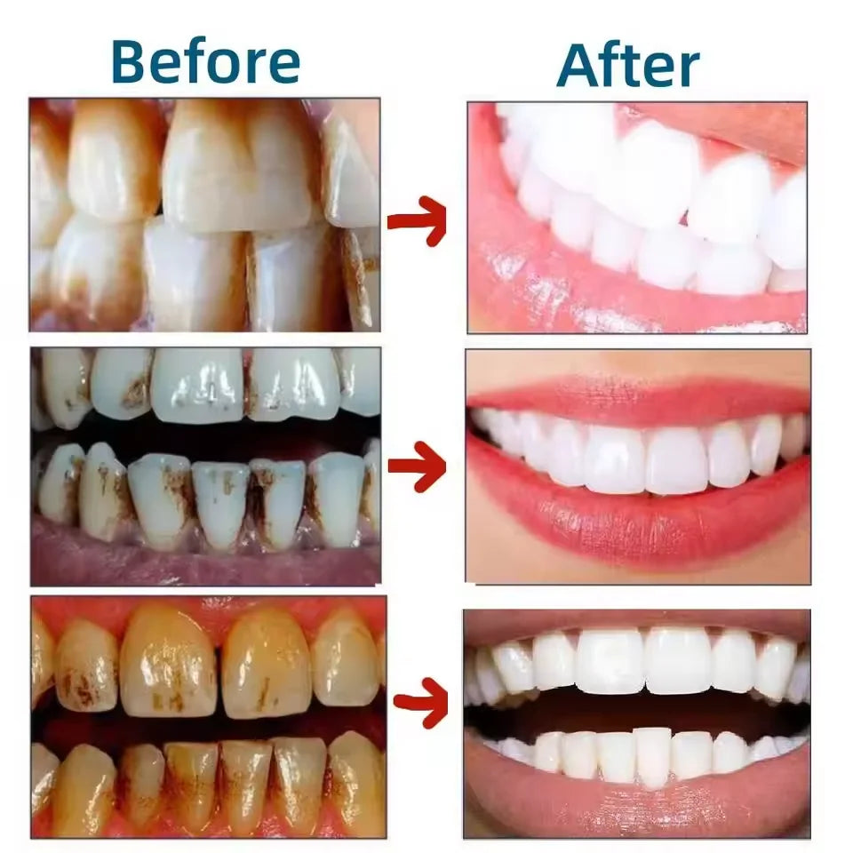 Teeth Whitening Toothpaste Serum Remove Plaque Stains Oral Hygiene Cleaning Dental Bleaching Tools Fresh Breath Tooth Care
