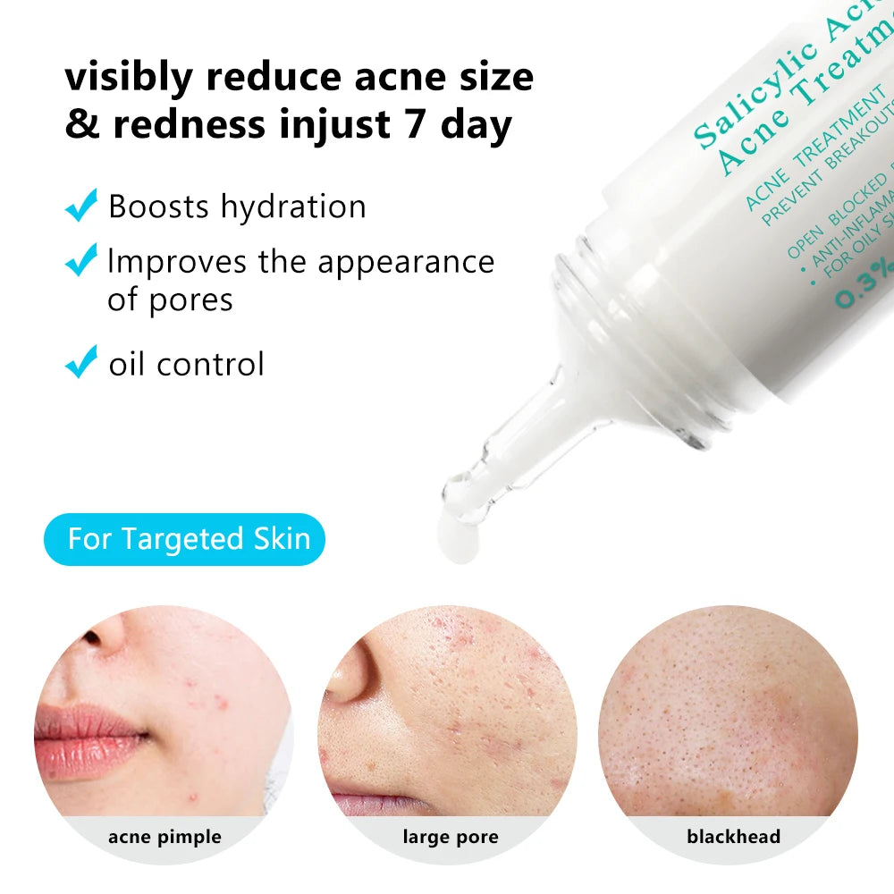 AUQUEST Salicylic Acid Acne Cream – Oil Control, Pore Care, Niacinamide, 15ml