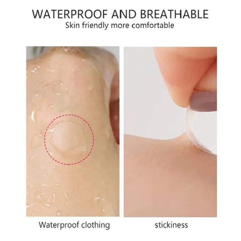 36 Patch Round Acne Patches Hydrocolloid Waterproof Pimple Removal Patches Invisible Acne Removal Patches Anti Acne Sticker