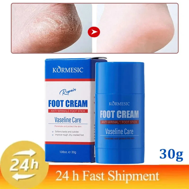 60% Urea Foot Cream Feet Heel Anti-Chapping Ultra-hydrating Softening Dry Cracked Product Gentle Exfoliation Daily Hand Foot Car