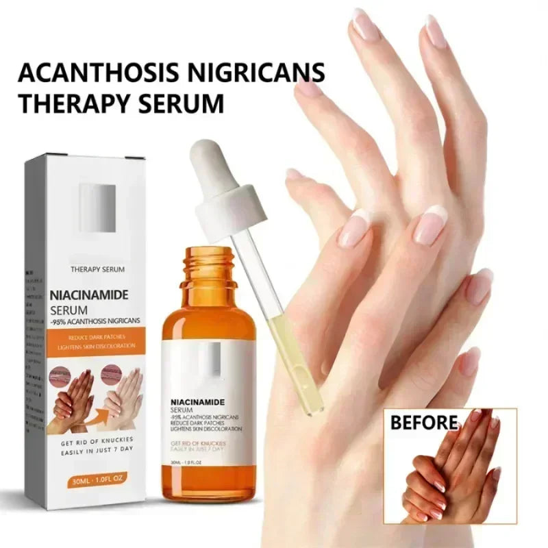 Dark knuckles whitening serum Elbows Armpit Beaching SerumWoman Private Part Skin Removal Dark Knuckles Strong Whitening Serum