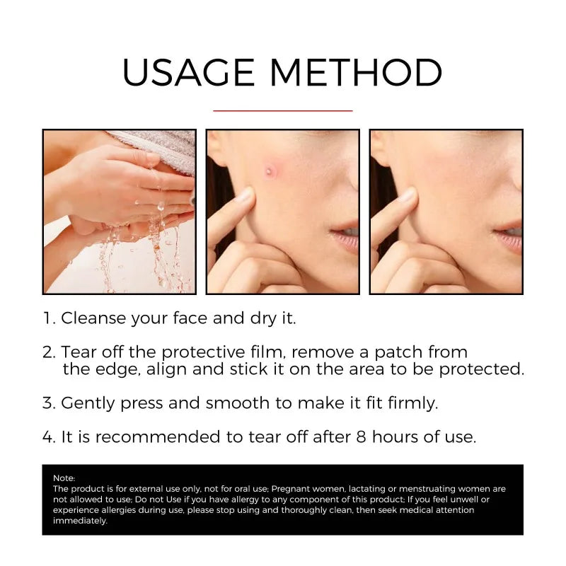 Acne Patch Pimple Cover Repair Facial Acne Treatment Smooth Skin Care Non-Irritating Mild Acne Pimple Patch
