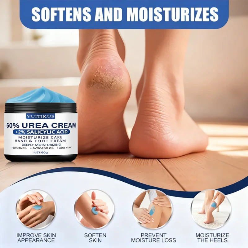 Urea Cream 60g - for Hands & Feet, Deeply Moisturizes & Softens Skin, Fast Absorption, Non-Greasy, All Skin Types