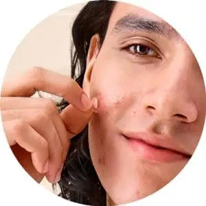 36 Patch Round Acne Patches Hydrocolloid Waterproof Pimple Removal Patches Invisible Acne Removal Patches Anti Acne Sticker
