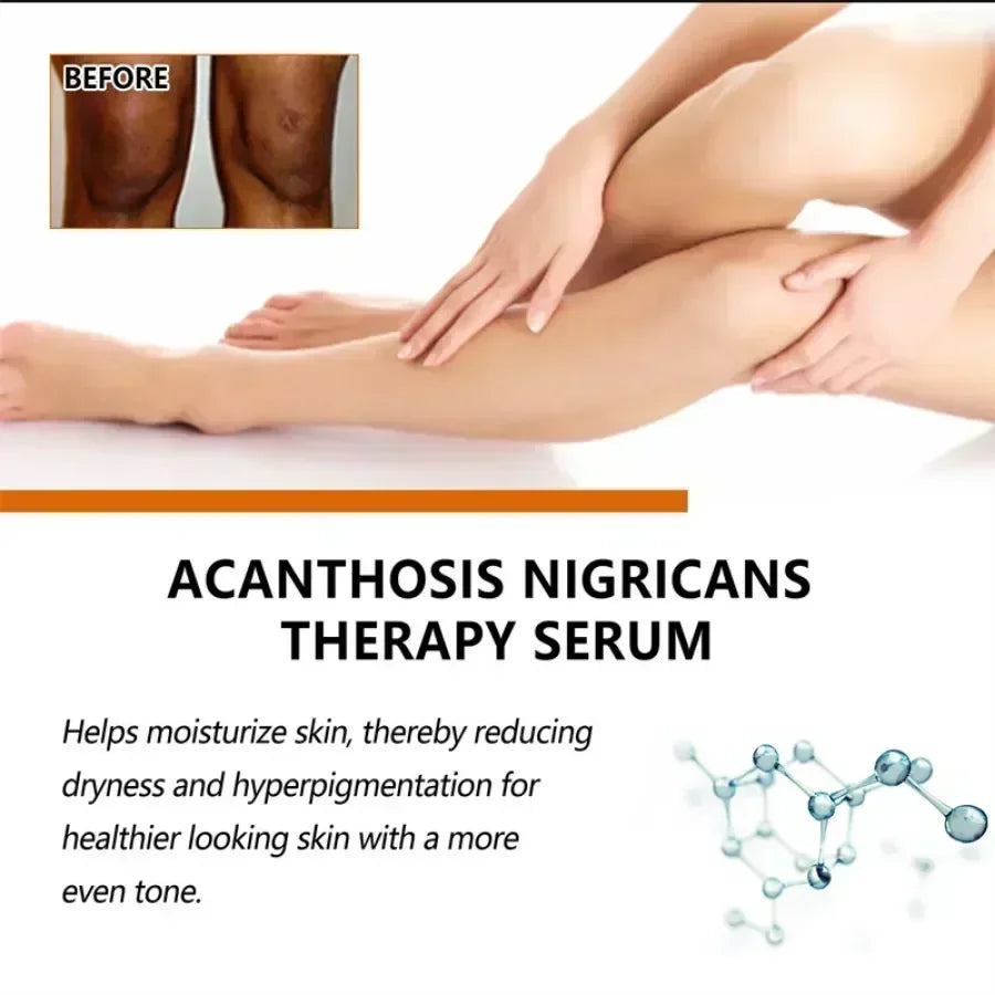 Dark knuckles whitening serum Elbows Armpit Beaching SerumWoman Private Part Skin Removal Dark Knuckles Strong Whitening Serum