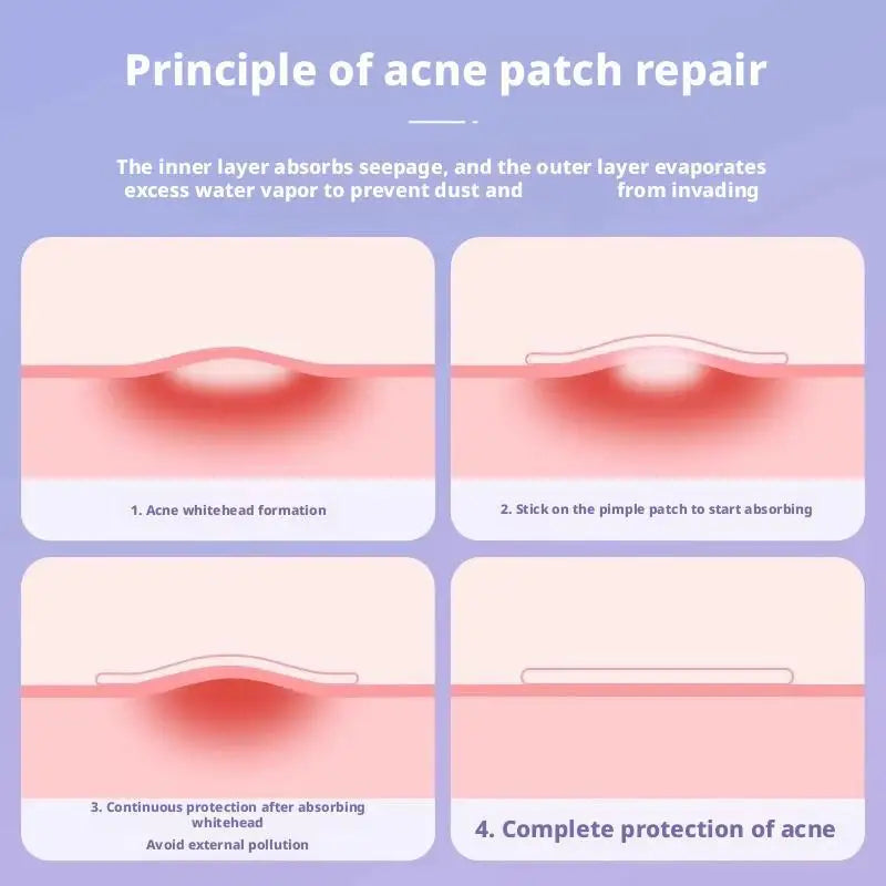Cartoon Acne Patches Cute Animal Shaped Design Waterproof Hydrocolloid Pimple Patches Gentle Breathable Portable Daily Worn