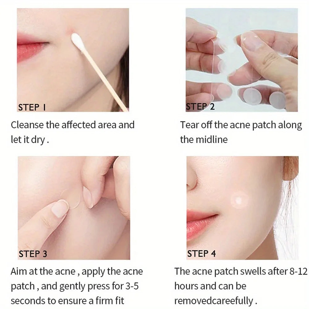 72pcs Acne Patch Facial Redness Repair Acne Clean Pores Moisturize and Smooth Skin Acne Patch Facial Stickers Skin Care Tools