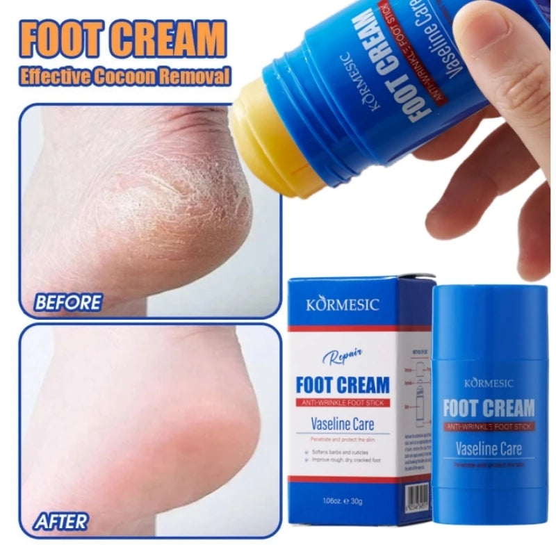 60% Urea Foot Cream Feet Heel Anti-Chapping Ultra-hydrating Softening Dry Cracked Product Gentle Exfoliation Daily Hand Foot Car