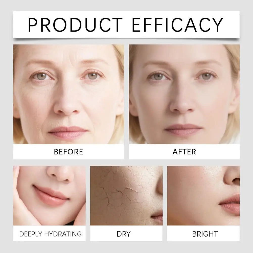 Hyaluronic Acid Stock Solutions Face Serum with Roller Microneedle Set Moisturizing Anti-Wrinkle Facial Serum Smoothing 0.25mm
