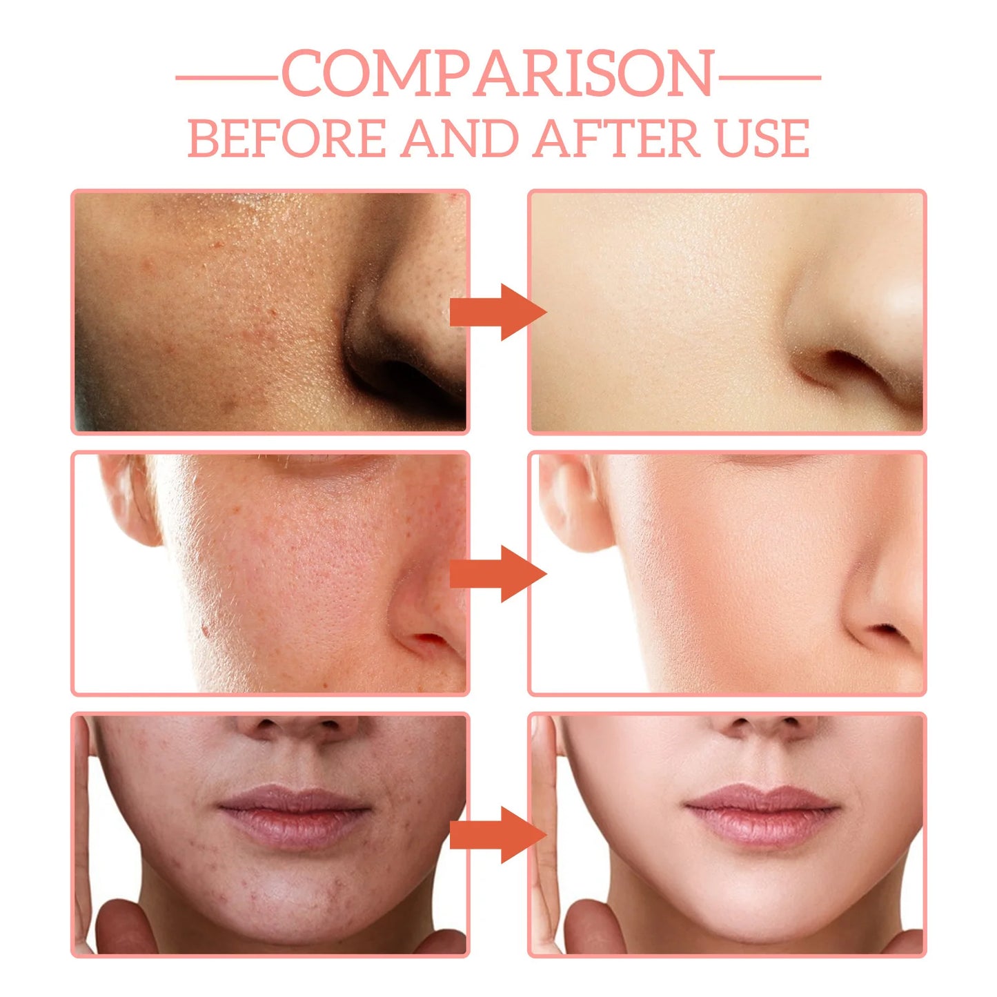5-in-1 Facial Serum Moisturizes Skin, Firms, Reduces Spots and Acne, Beauty Enhancing Serum