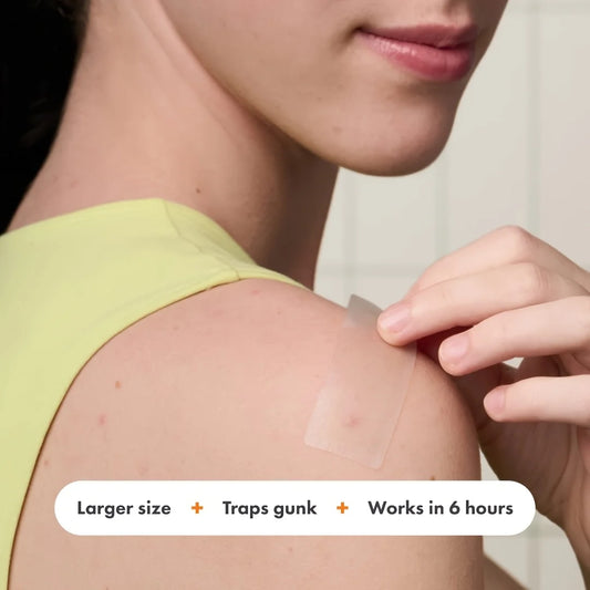 20PCS Acne Scar Patches for Adults - Pore-Cleansing, Ultra-Thin, Alcohol-Free, Fragrance-Free, For All Skin Types