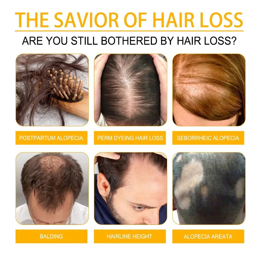 WestMonth Hair Care Essential Oil Moisturizes Nourishes Softens And Brightens Hair Care Oil