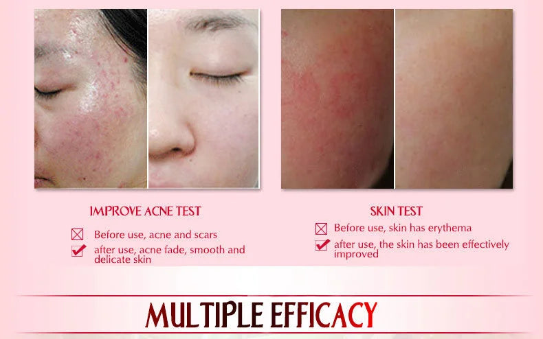 ARTISCARE Snail Essence 3pcs for Moisturizing and Nourishing Face Serum Skin Care Cream
