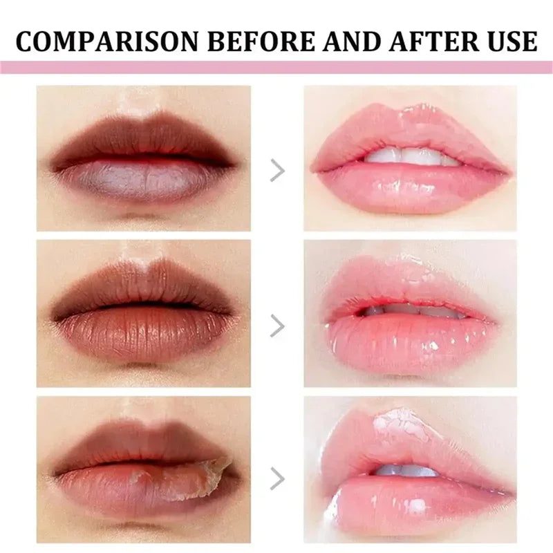 Remove Dark Lip Balm Lightening Melanin Mask Gloss Exfoliating Lip Pink Treatment Reduce Lip Lines Improve Dryness Moisturizing