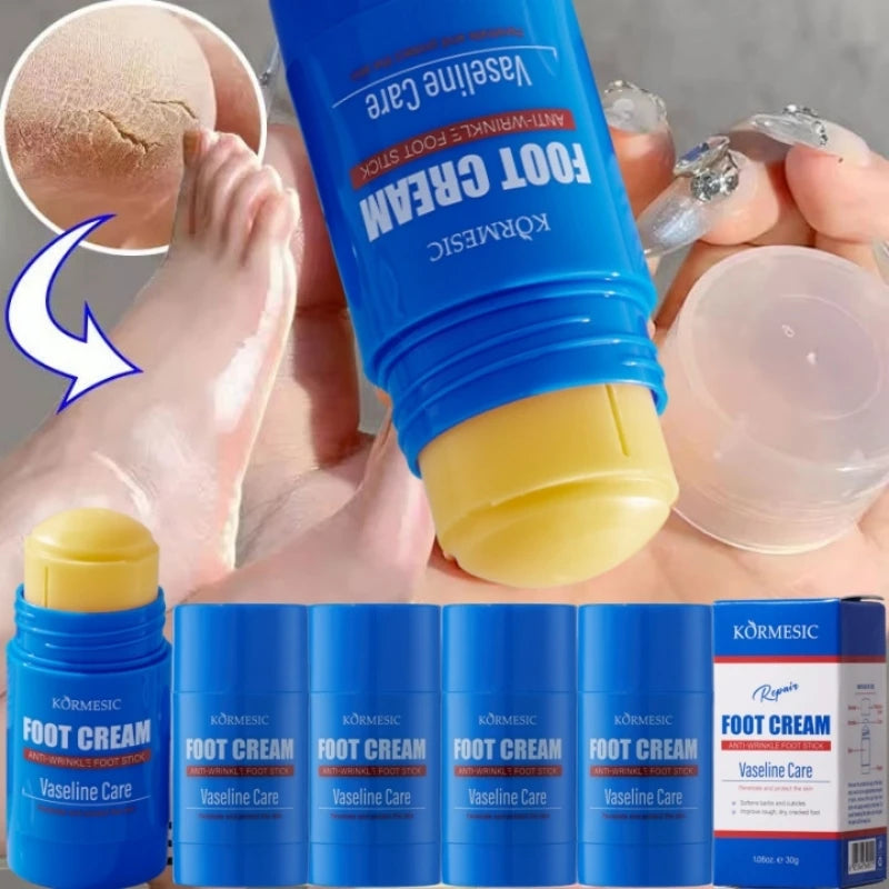 60% Urea Foot Cream Feet Heel Anti-Chapping Ultra-hydrating Softening Dry Cracked Product Gentle Exfoliation Daily Hand Foot Car