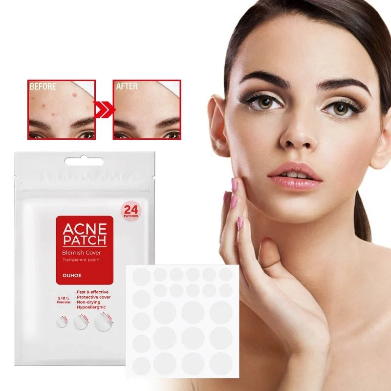 Acne Patch Pimple Cover Repair Facial Acne Treatment Smooth Skin Care Non-Irritating Mild Acne Pimple Patch