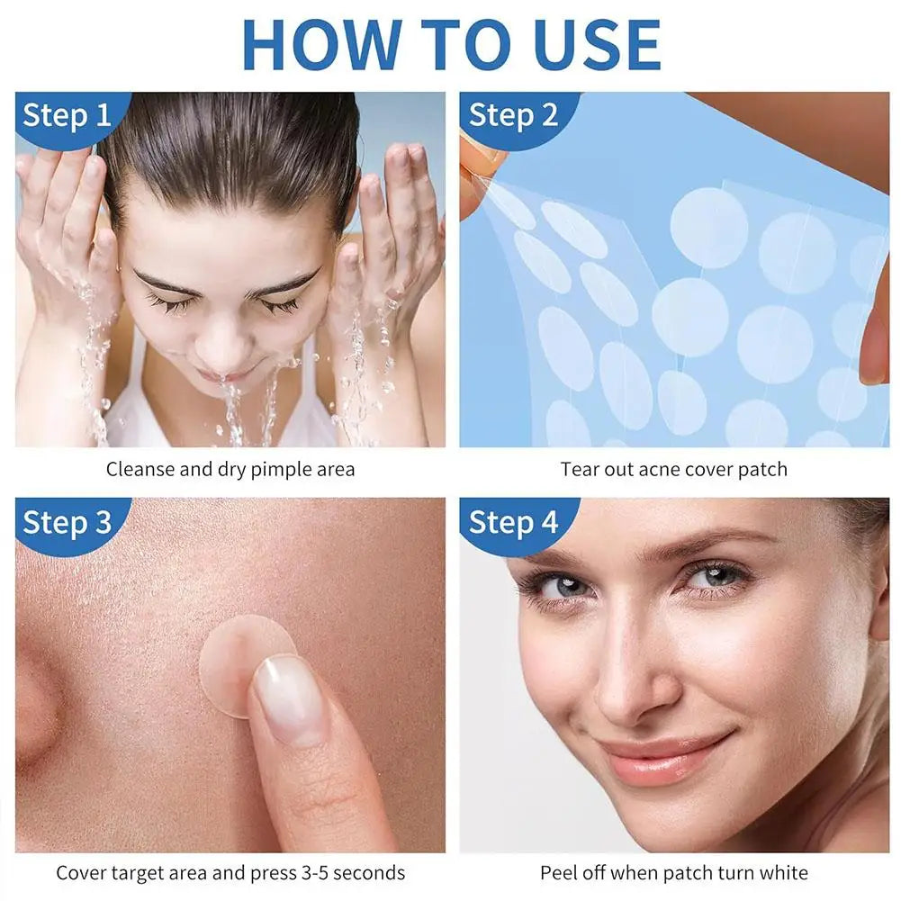 262/360Pcs Cute Colorful Pimple Patches Acne Treatment Stickers Invisible Acne Cover Face Spot Pimple Patch Skin Care Makeup