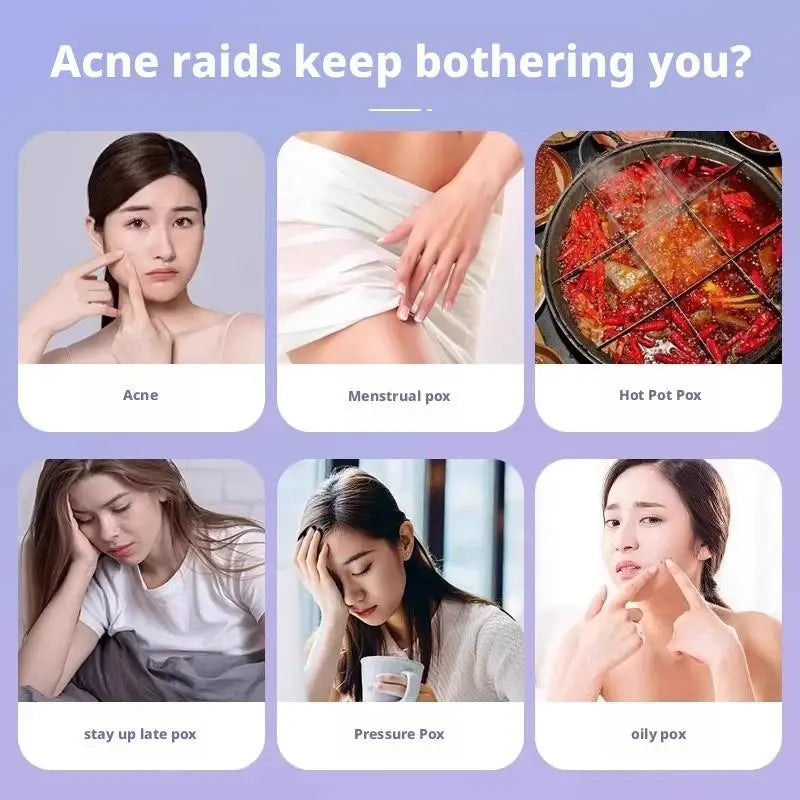 Cartoon Acne Patches Cute Animal Shaped Design Waterproof Hydrocolloid Pimple Patches Gentle Breathable Portable Daily Worn