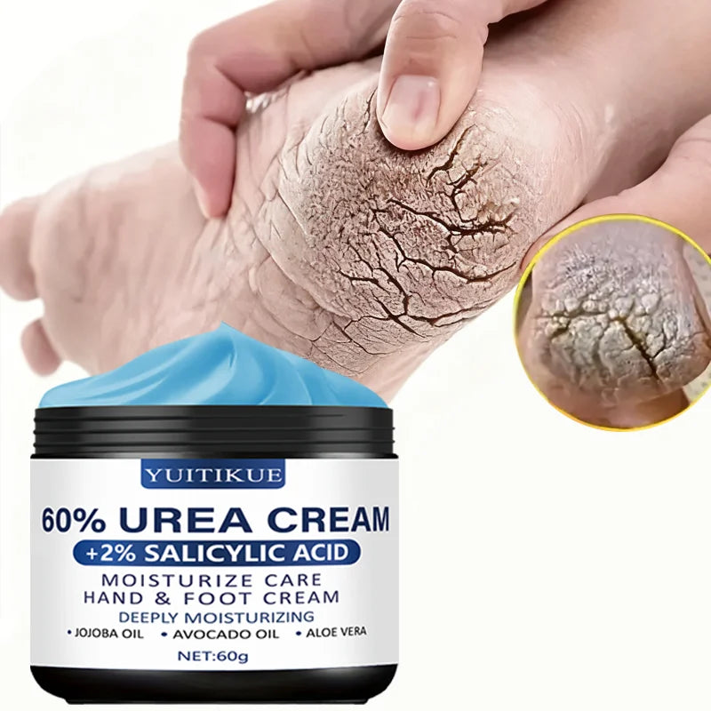 Urea Cream 60g - for Hands & Feet, Deeply Moisturizes & Softens Skin, Fast Absorption, Non-Greasy, All Skin Types