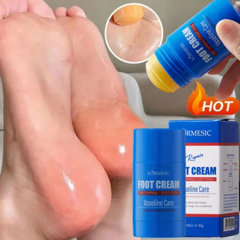 60% Urea Foot Cream Feet Heel Anti-Chapping Ultra-hydrating Softening Dry Cracked Product Gentle Exfoliation Daily Hand Foot Car