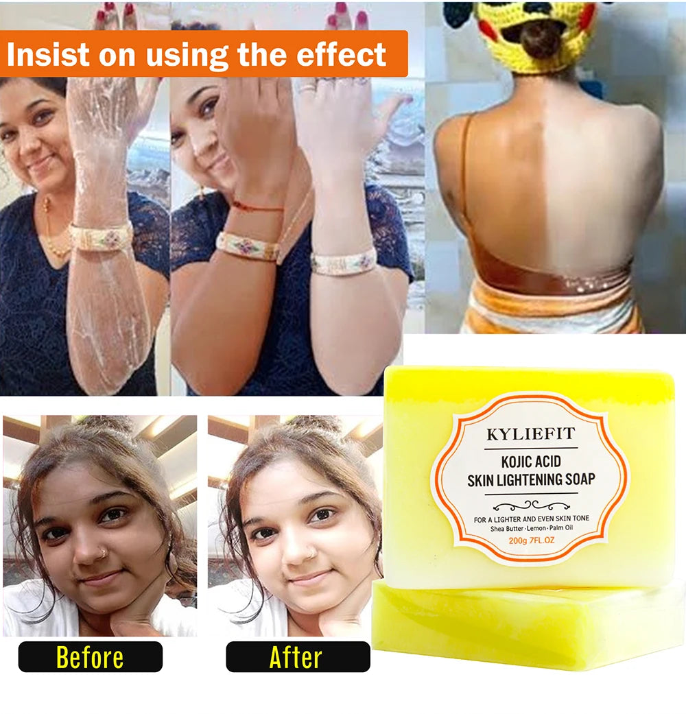 KYLIEFIT Lemon & Turmeric Perfect Combination Body Scrub, Whitening, Moisturizing, Anti Oxidation, Exfoliate,Brighten Skin Tone