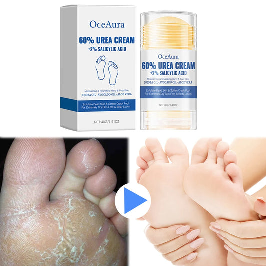 40g Anti-Cracking Foot Cream Rescues Cracked Feet Exfoliating Foot Ointment Foot Moisturizing Stick for Dry Cracked Feet