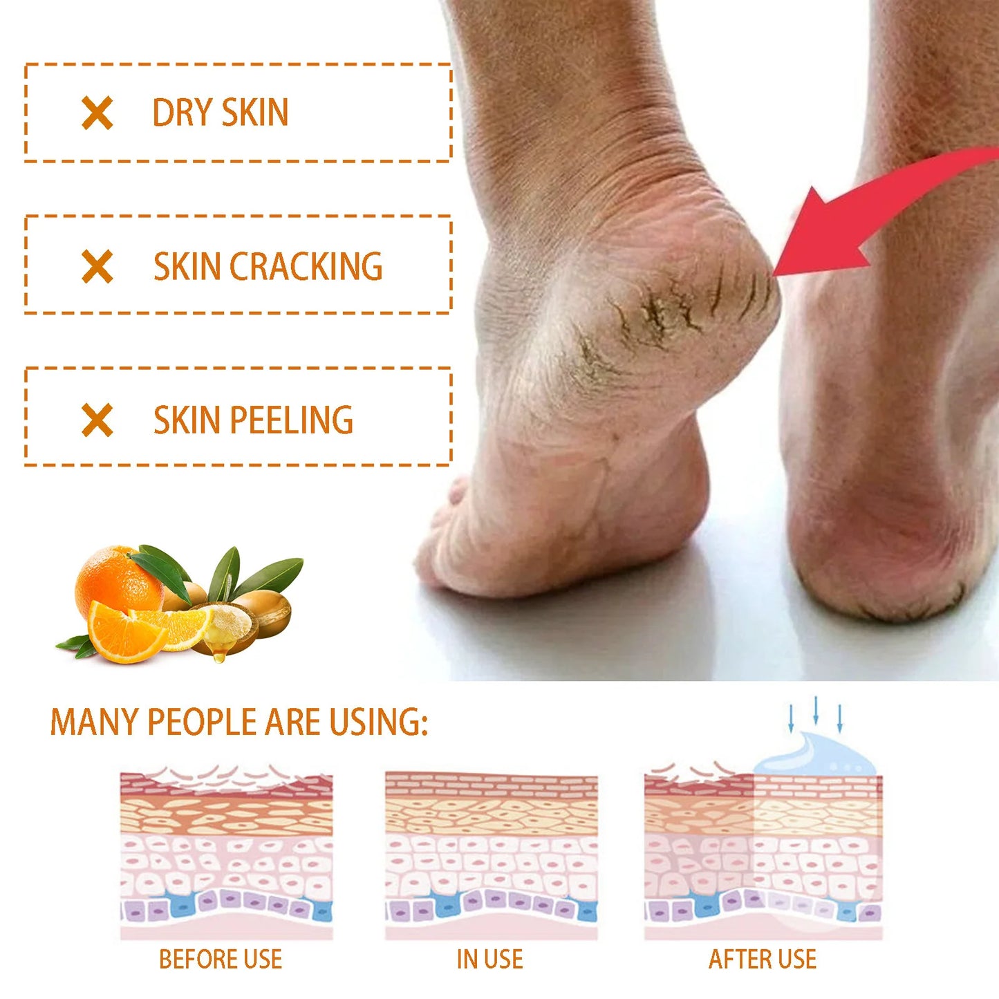 Anti Crack Foot Cream Remove Dead Skin Calluse Drying Repair Heel Chapping Smooth Nourishing Exfoliating Moisturizer Foot Cream