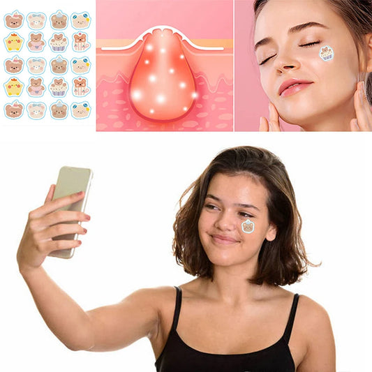 100PCS Cute Bear Pimple Patches | Colorful Hydrocolloid Acne Stickers with Strong Absorption