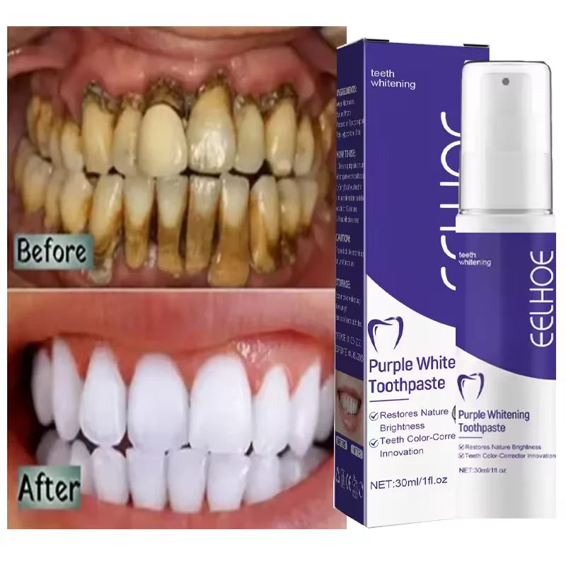 Teeth Whitening Toothpaste Serum Remove Plaque Stains Oral Hygiene Cleaning Dental Bleaching Tools Fresh Breath Tooth Care