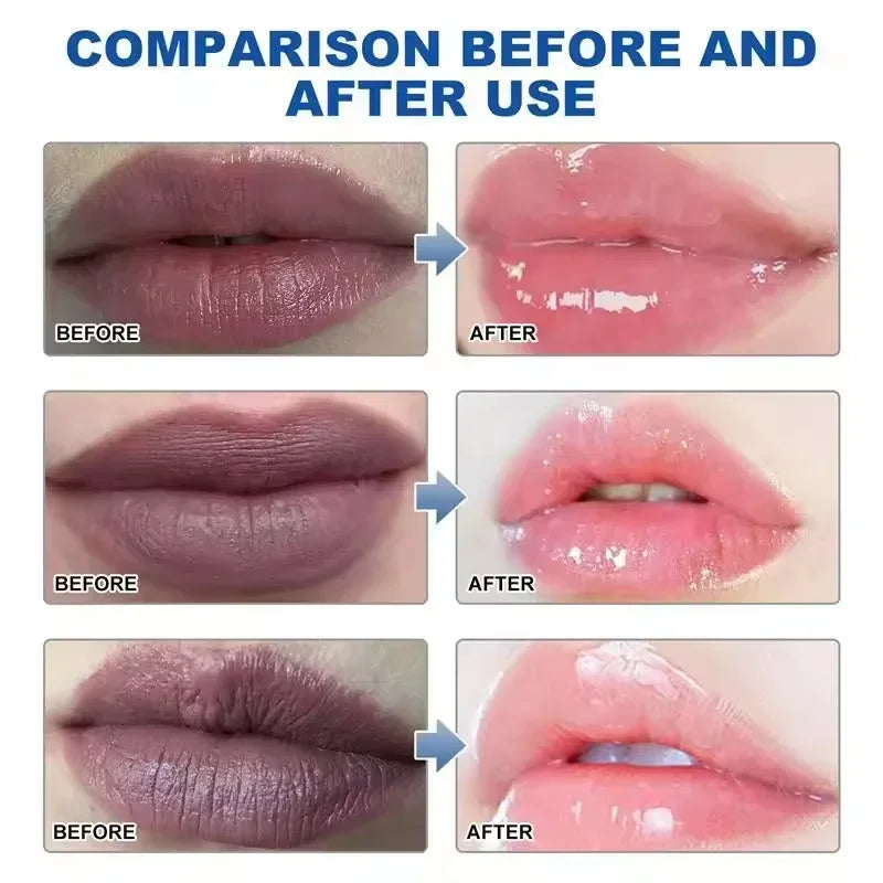 Remove Dark Lip Balm Lightening Melanin Mask Gloss Exfoliating Lip Pink Treatment Reduce Lip Lines Improve Dryness Moisturizing