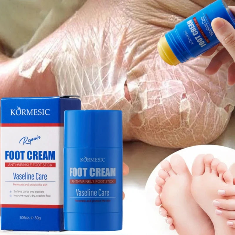 60% Urea Foot Cream Feet Heel Anti-Chapping Ultra-hydrating Softening Dry Cracked Product Gentle Exfoliation Daily Hand Foot Car