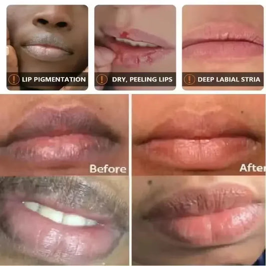 Remove Dark Lip Balm Lightening Melanin Mask Gloss Exfoliating Lip Pink Treatment Reduce Lip Lines Improve Dryness Moisturizing