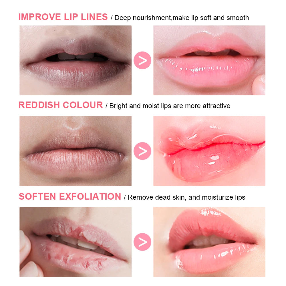 Brightening Pink Lip Balm Reduces Lip Lines Lips Moisturizing Hydrating Removing Dead Skin Fruity Moisturizing Korea Lip Balm