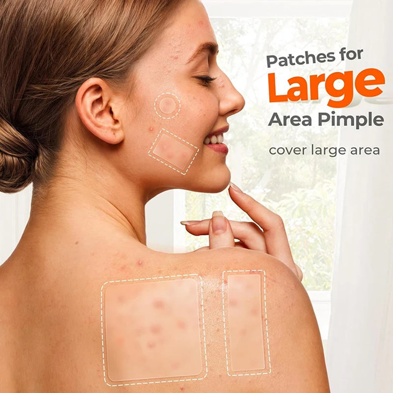 Large Capacity Acne Patch Hydrocolloid Salicylic Transparent Acne Patch Invisible Acne Removal Skin Care Stickers Face Beauty