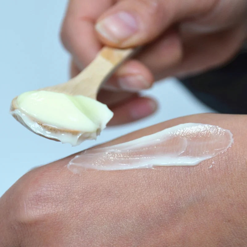 300g/10.58 OZ Curing Keratosis Pilaris Chicken Skin Body Lotion Skin Repair Cream Skin Care Essence Moisturizing And Nourishing