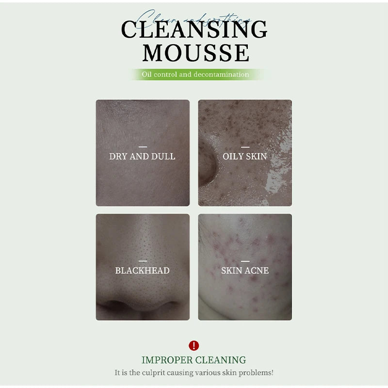 Facial Cleansing Mousse with Brush Head,Oil Control Pores Decontamination Face Cleaner,Mild Hydration Soothing Purifying Foam