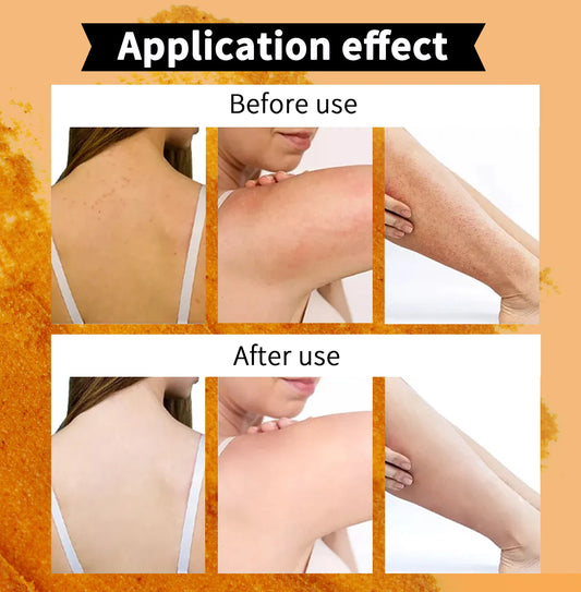 KYLIEFIT Lemon & Turmeric Perfect Combination Body Scrub, Whitening, Moisturizing, Anti Oxidation, Exfoliate,Brighten Skin Tone