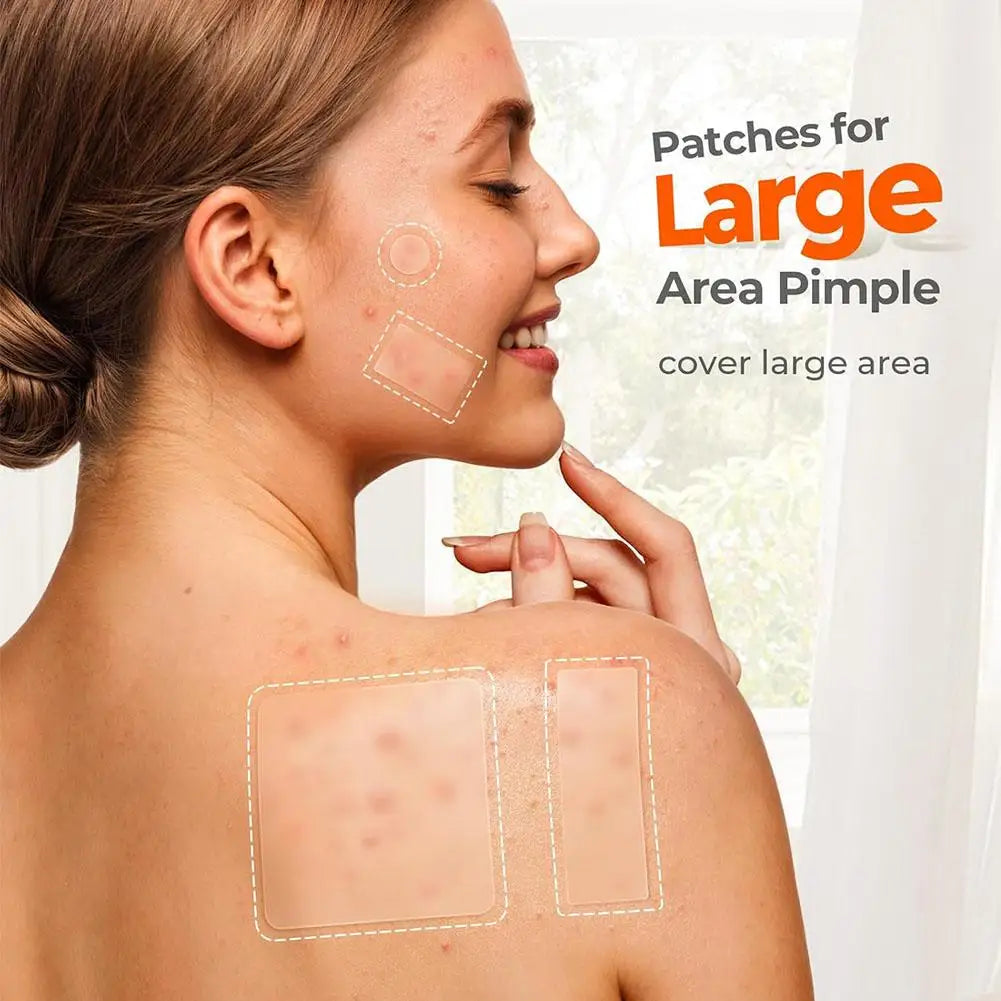 Acne Care Patch Anti-inflammatory Healing Absorbing Spot Sticker Covering Acne Skin Care Stickers Multiple Shapes Pimple Patch