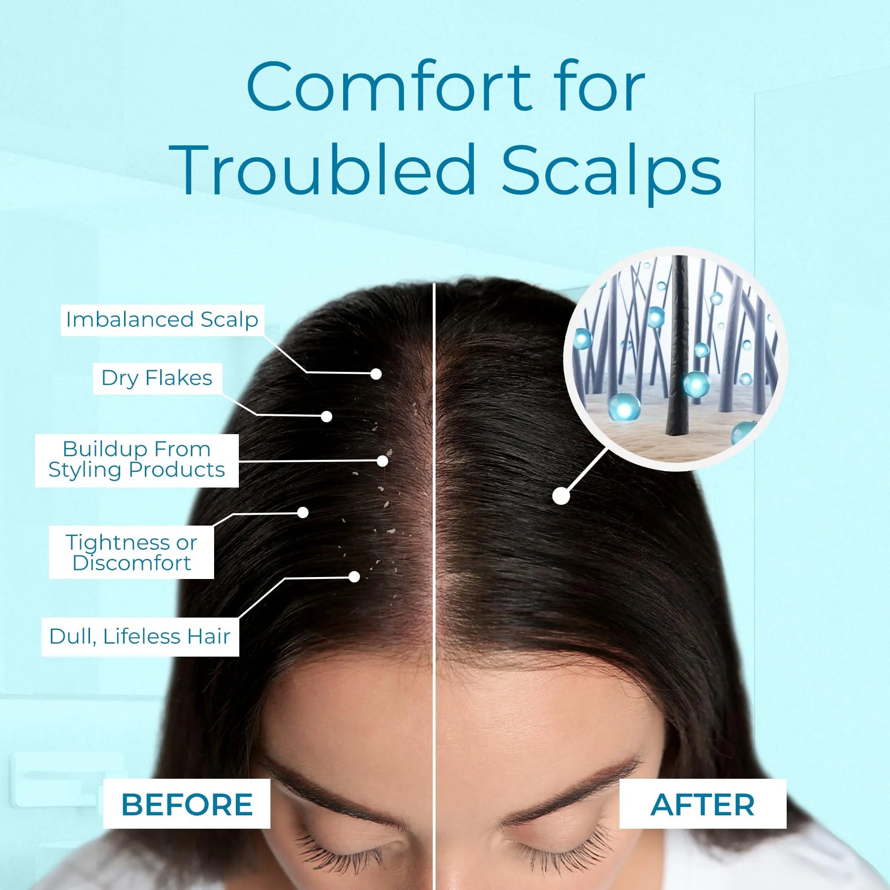 Dry Scalp Spray - Intensive Scalp Moisturizer for Men & Women - Tea Tree Leave in Scalp Moisturizer for Dry Scalp, Flaky Buildup & Excess Oil