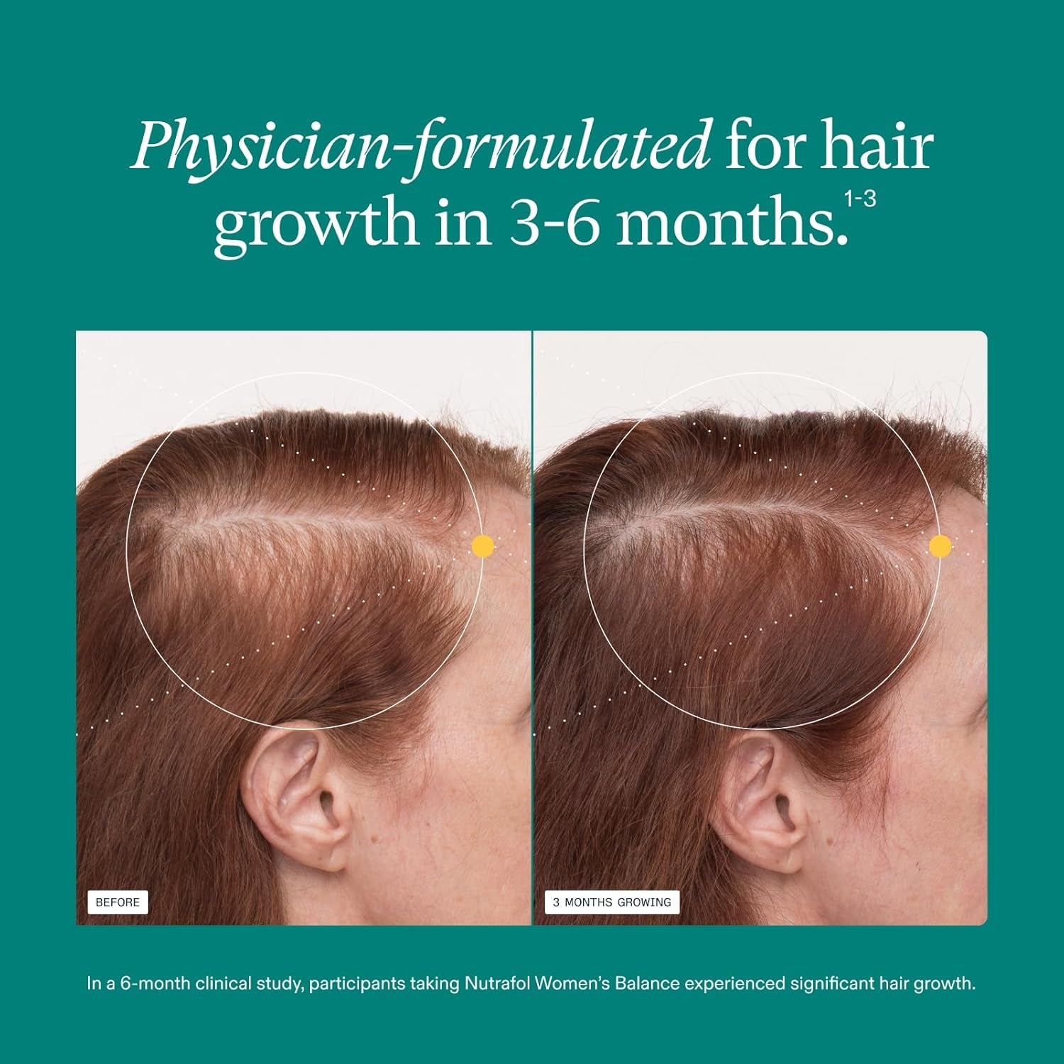 Women'S Balance Hair Growth Supplements, Ages 45 and Up, Clinically Proven for Visibly Thicker Hair and Scalp Coverage, Dermatologist Recommended - 1 Month Supply